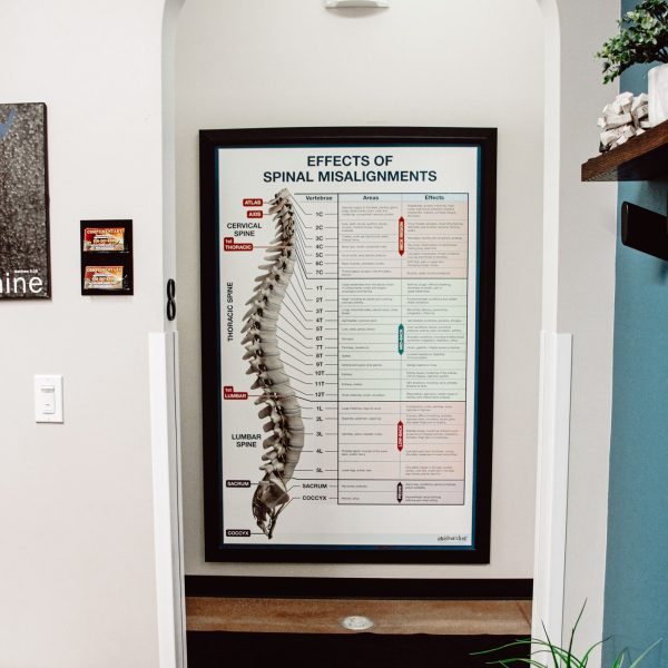 chiropractic effects